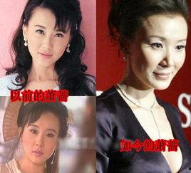 吃瓜整容女明星视频播放,吃瓜群众热议的整容女明星，视频播放量惊人！